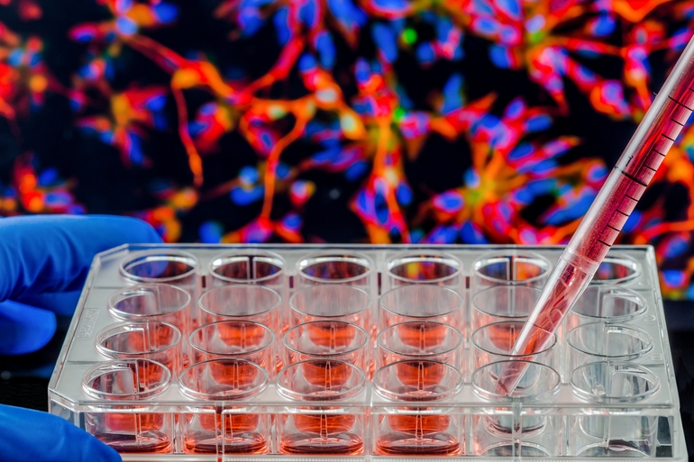 BioMed X to establish first U.S.-based research institute in New Haven. Story via #NewHavenBIZ. bit.ly/3DcxuVb