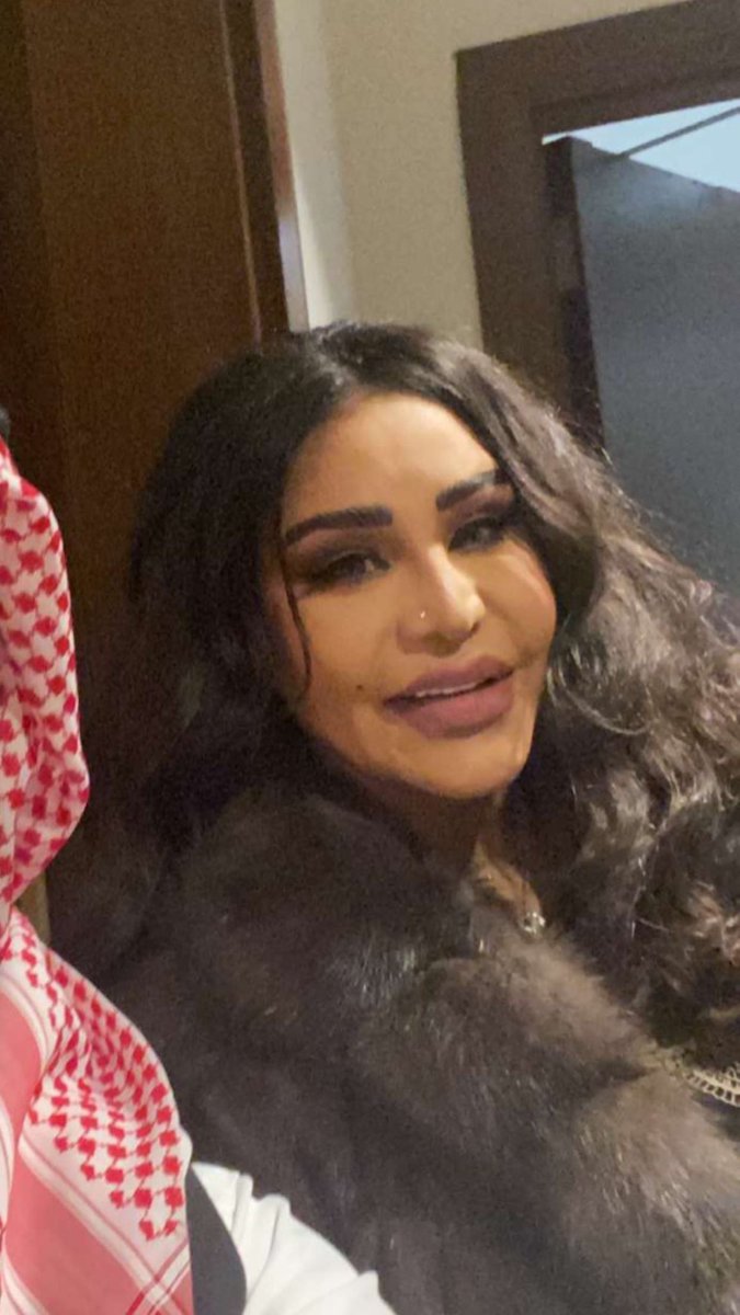 TheSnake_S's tweet photo. شفت احلام اليوم وعرفتني 😂❤️ اغلى من يعرفني و اعز واغلى من شفت اليوم ❤️ ذهبه ترحب بالكل وتوقف وتصور ، مافيه مثلها ❤️❤️❤️❤️ https://t.co/lGzTSmeudS