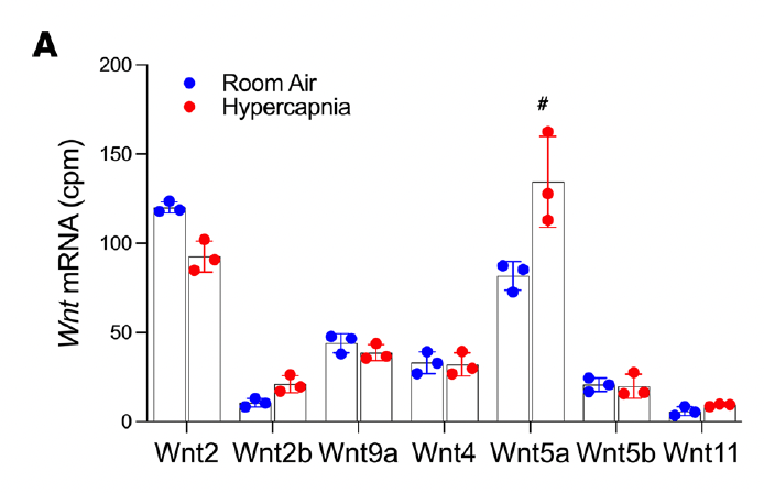 GottardiLab's tweet photo. AT2 cell #Wnts didn't appear to be the answer… but Wnts made by AT2-associated stromal niche cells provided a clue, with the two most abundant #Wnt2 and #Wnt5a inverting their typical expression (4/11). https://t.co/Q2whQ4ibbt