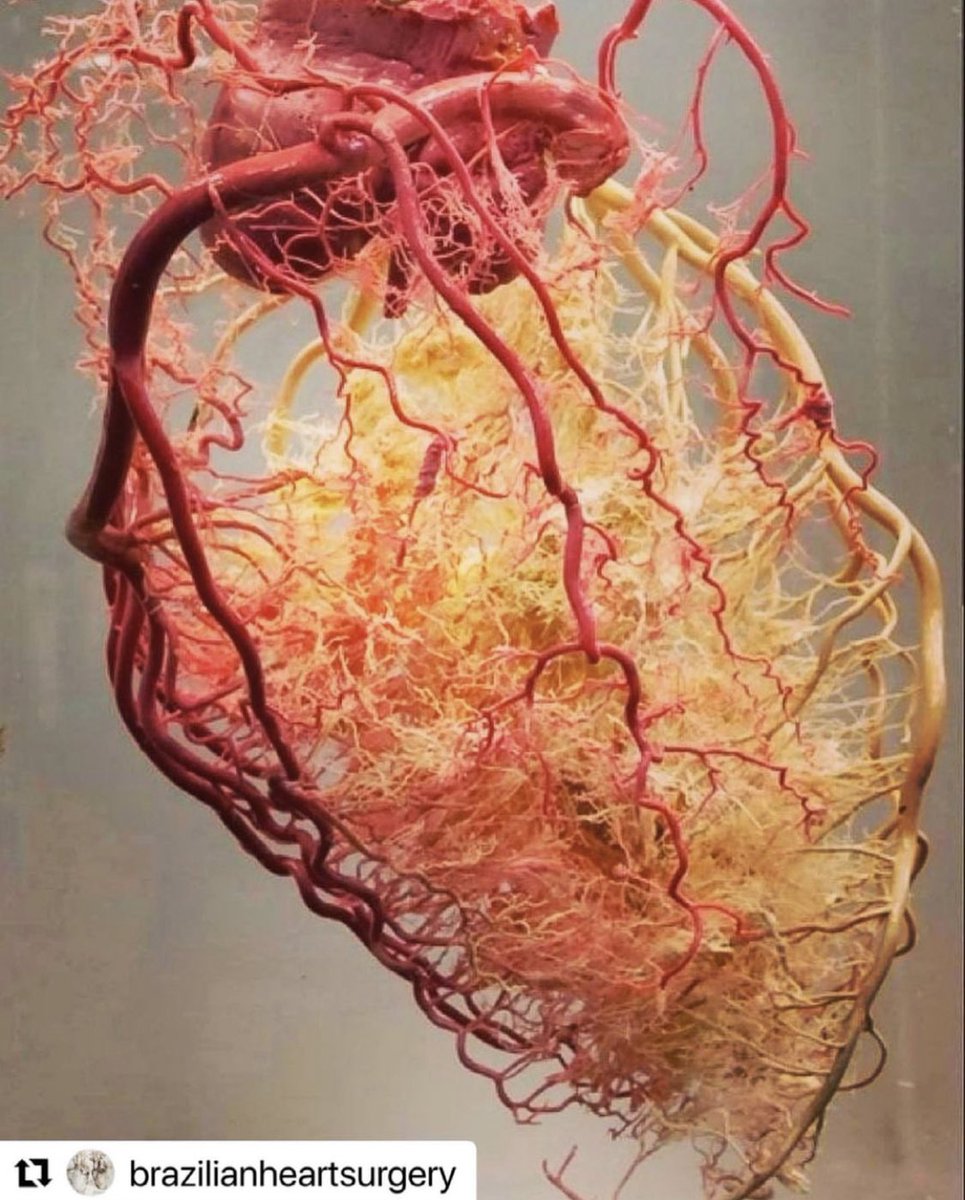 AvrahamCooperMD's tweet photo. Every blood vessel in the human heart 🫀 

#MedTwitter https://t.co/GgYEtJuVfQ