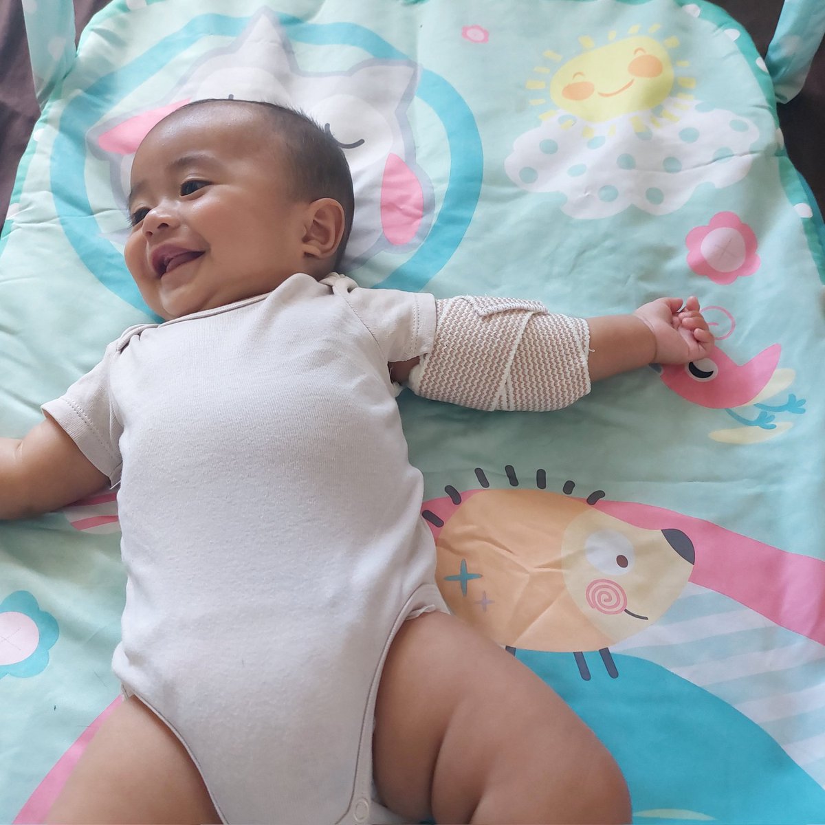 beyabeysss's tweet photo. Viggo had his first major accident today 😞 he rolled off the bed and ended up with an arm fracture... We're glad he's in good spirits now and bless his little heart for still smiling despite the pain he's surely feeling 🥺 but def a learning moment for us as parents to be better https://t.co/xJuwOi2Qvr