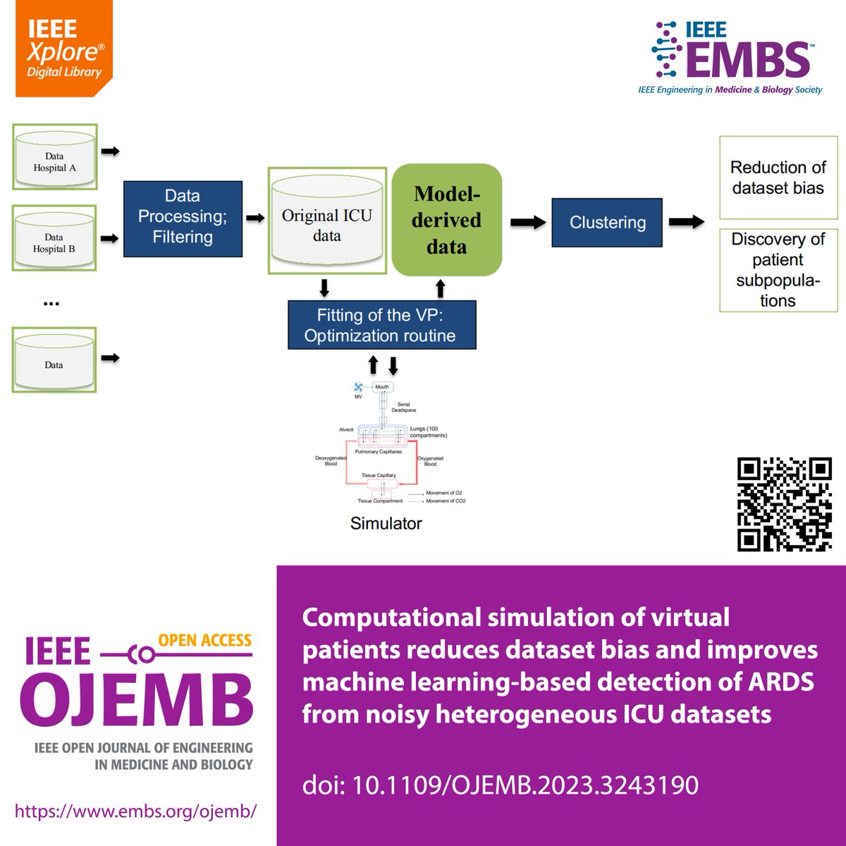 IEEE Open J of Engineering in Medicine & Biology (@ieeeojemb) on Twitter photo Researchers from <a href="/SMITHKonsortium/">SMITH. Smart Medical Technology for Healthcare.</a> release a new framework for individualized ICU virtual patient modeling: How virtual patient modeling supports machine learning-based recognition of ARDS in ICU? bit.ly/3KzO6uz #OJEMB #MachineLearning #AI #DigitalTwin #ARDS #ICU Researchers from <a href="/SMITHKonsortium/">SMITH. Smart Medical Technology for Healthcare.</a> release a new framework for individualized ICU virtual patient modeling: How virtual patient modeling supports machine learning-based recognition of ARDS in ICU? bit.ly/3KzO6uz #OJEMB #MachineLearning #AI #DigitalTwin #ARDS #ICU