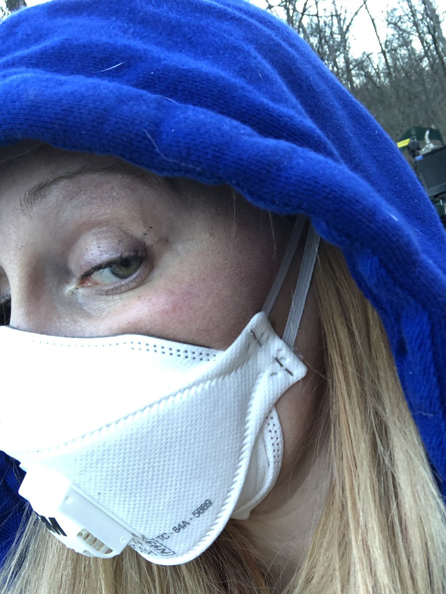 AshleyMcCollumm's tweet photo. Yesterday’s trip to the creek. Mild skin dashing with burning feeling. We could smell the chemical through our masks. Very alarming symptoms followed. #epstrong #eastpalestine #norfolkmustpay #eastpalestineohio https://t.co/H7KDJhnEPm