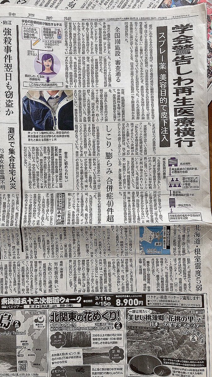 dx_cow's tweet photo. 昨日の神戸新聞にて、PRP＋FGF注射について取り上げられてました。インフルエンサー達がこぞって宣伝し始めた時に調べ、要はフィブラストスプレー使ってるとわかり震えた。そして、やっぱり合併症に苦しんでる人がいる。普段病棟でフィブラストスプレー使ってる���からすると、これが何で→続く https://t.co/qdQOMCwu4y