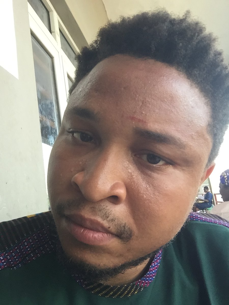 See what these APC thugs did to me because we didn't let them alter #Alimosho results. They used sticks, stones, hoards of them... One wanted to stab me with a knife, but one of the LP agents held his hand. Then one of them snatched my iPhone. My life is in that iPhone.