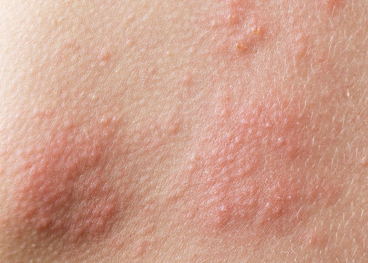 ezzahnor's tweet photo. Top 10 shower gel/wash for eczema &amp; sensitive skin. 

Itchy &amp; dry skin peeps, this thread is for you: https://t.co/35u9BHNJ9t