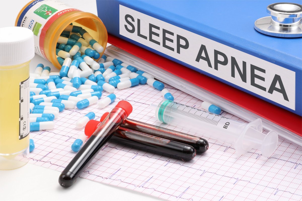 Mayo Clinic - Throat exercises for snoring and sleep apnea
#StopSnoring #SleepApnea #ThroatExercises
#BetterSleep
sharecta.com/l/12i9hmrjtrrm