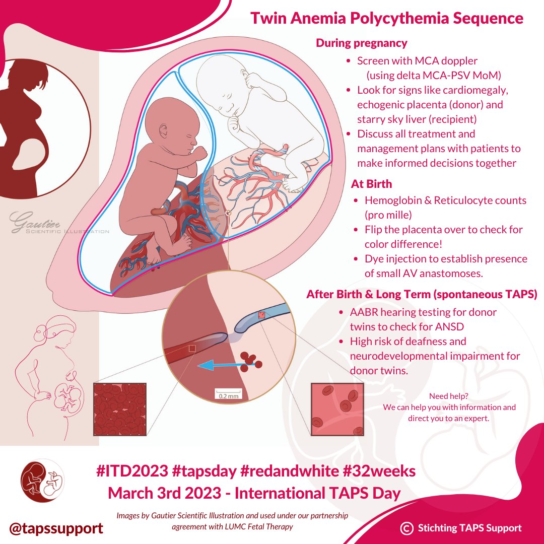 tapssupport's tweet image. March 3rd is International TAPS Day. #TAPStwins are born at an average of 32 weeks, with many challenges caused by our #raredisease and #prematurity. Join us:  bit.ly/3ovBIjL #32weeks #redandwhite #tapsday #itd2023 @tapssupport