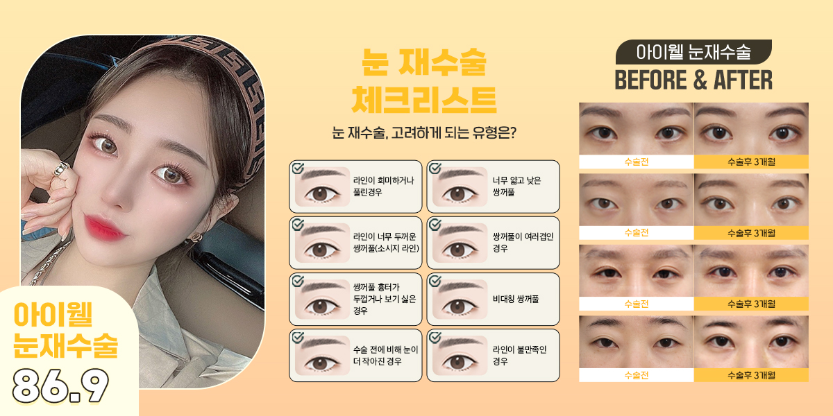 iwellps's tweet photo. 💖아이웰 눈재수술💖

눈재수술도! #아이웰성형외과
속상한 마음까지 치유🏥
이번 수술이 진짜 마지막이 되도록!
숙련된 성형외과 전문의의 정확한 문제파악과
환자에게 가장 적합한 수술 진행까지!
믿고 맡길 수 있는 아이웰로 오세요💖 

📞 상담문의: 02-542-2017
💛 카톡상담: @아이웰성형외과 https://t.co/7JbICv7jPL