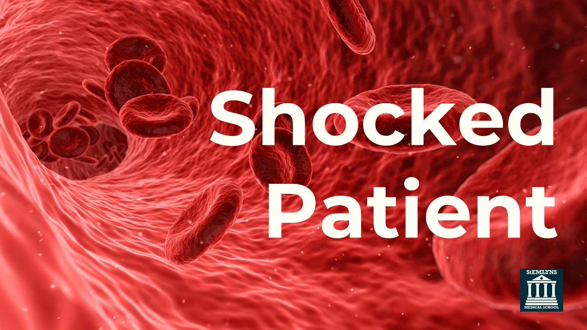Topic of the Day = Shock. 
Listen to this podcast from <a href="/stemlynsmedsch/">St Emlyn's Medical School</a> about the physiology and causes of shock. open.spotify.com/episode/1tduFk…
#FOAMed #shock