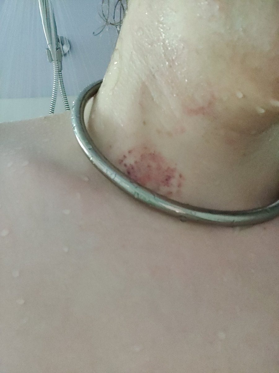 Titanium is no defense against a determined cat.