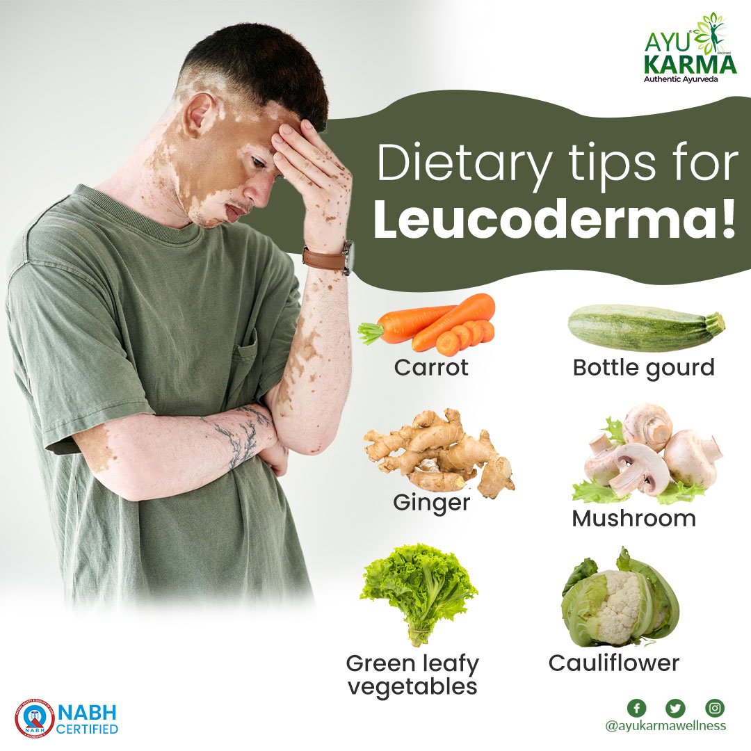 AyuKarmaCentre's tweet image. Here is a laundry list of foods you can include in your diet which is beneficial in fighting Leucoderma! 
.
.
#Leucoderma #leucodermatreatment #leucodermacure #Ayurveda #AyurvedicDoctor #AyurvedicTreatment #ayukarma