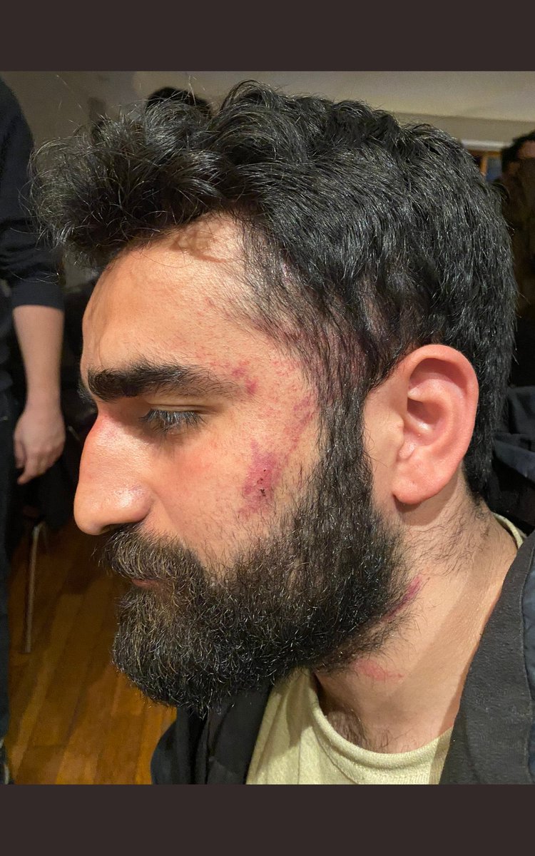barisatay's tweet photo. Arkadaşlarımız günlerce yemek yemedi, uyumadı. Duydukları her sese koştular, çabaladılar, hayatlar kurtardılar. @Kizilay’ın yaptığı arsızlığı, dolandırıcılığı protesto ediyorlar diye onlara yapılan işkence etmek. Sizlerle çok büyük hesabımız var. İktidarınızı başınıza yıkacağız! https://t.co/1ZuoMvrLuZ
