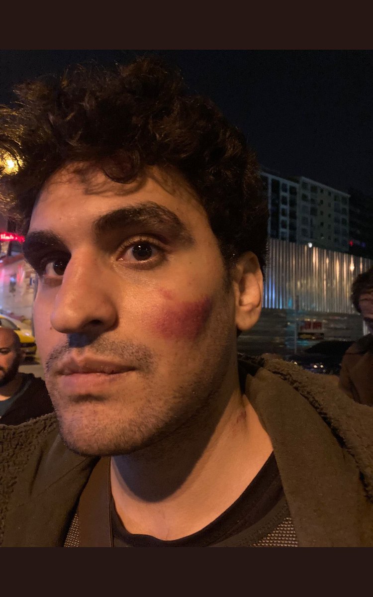 Arkadaşlarımız günlerce yemek yemedi, uyumadı. Duydukları her sese koştular, çabaladılar, hayatlar kurtardılar. <a href="/Kizilay/">Türk Kızılay</a>’ın yaptığı arsızlığı, dolandırıcılığı protesto ediyorlar diye onlara yapılan işkence etmek. Sizlerle çok büyük hesabımız var. İktidarınızı başınıza yıkacağız!