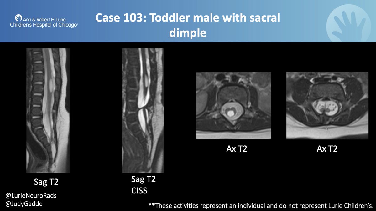 Judy Gadde, DO, MBA on Twitter "Lurie Peds Neuro Case 103 History