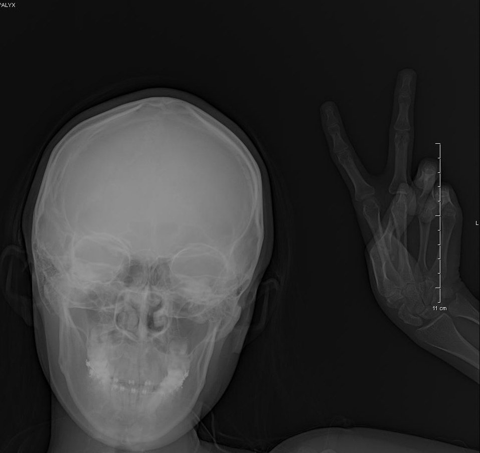 🔸️alyx🔸️dottore brainrot 🐀 on Twitter "took a selfie using the xray