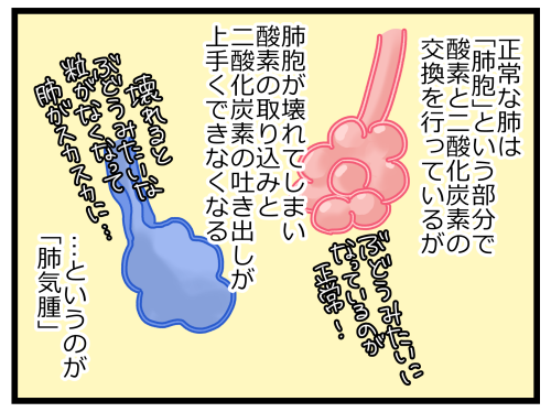 数年前に義父が倒れた時の話③ 1/2

義父の病状は「COPD」という、「肺気腫」と「慢性気管支炎」からなるもので、タバコの喫煙が原因でした。 