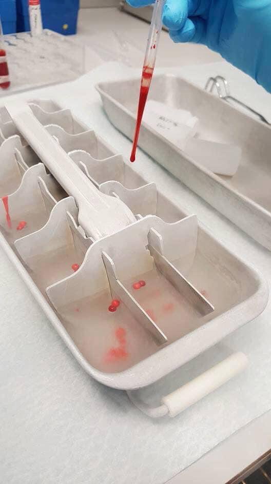 CarloMedLabSci's tweet photo. RBC preservation by droplet freezing is so cool!….. and reminds me of Dippin’ Dots 😂😂😂

#BloodBank https://t.co/fHLFsvFHYE