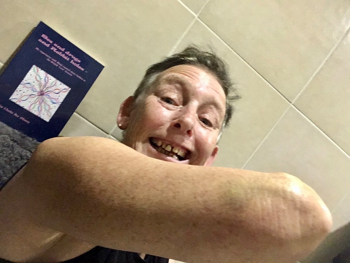 HigherInsight1's tweet image. I’m not writing it all again as I have but instead give you the link to the rest. 
instagram.com/p/Corfc-BNgNQ/

to like this

higherinsight #Fading #Triangularmark that #Lookslikeabruise 
#Toblarone its #outonitsown 
#triangularchocolate 
For#TriangularPeople