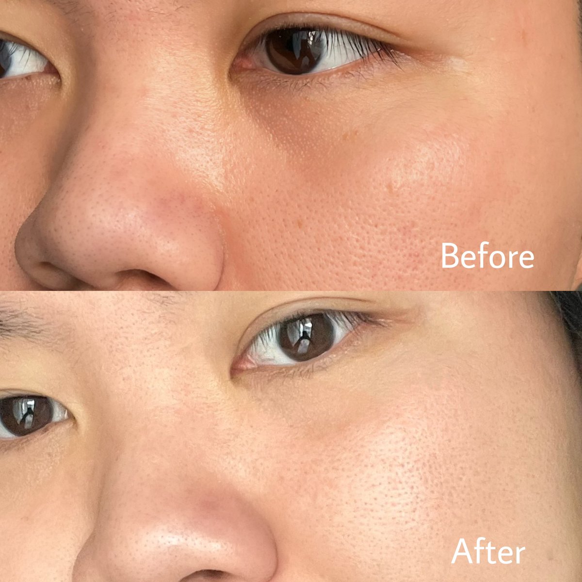 chubbysine_'s tweet photo. ได้ลองใช้confidence in a cream ของ IT Cosmetics สูตรใหม่แล้วชอบมากก ช่วยเรื่องริ้วรอยและเติมความชุ่มชื้น เราใช้มาสองวีคผิวกระชับขึ้น รอยจางลง เนื้อครีมสบายผิวไม่หนักมากเหมาะกับคนหน้าแห้งหรือผิวมันขาดน้ำ ใช้ช่วงหน้าหนาวแล้วฟินเวอร์ #ITCosmeticsTH #No1SuperCharged https://t.co/nb9hyc3QiC