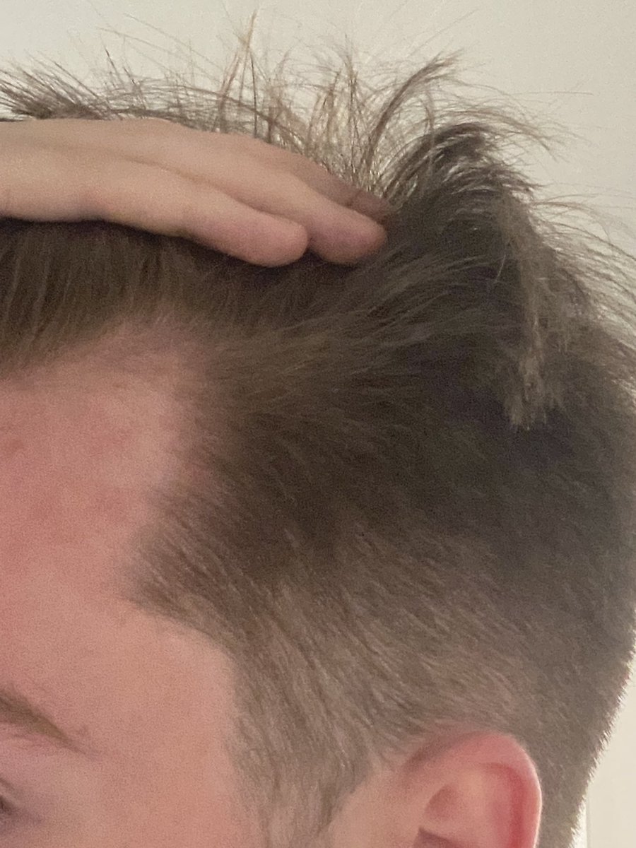 WAVE Chanti tweet media