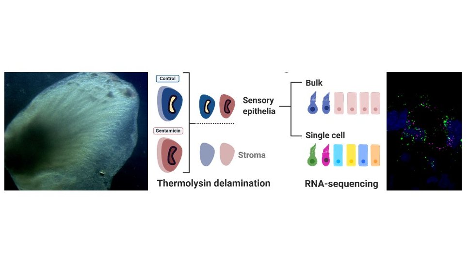 LabDabdoub's tweet photo. Does the human utricle have a regenerative response? Today @EmiliaLuca_PhD has a podium presentation discussing her latest results using a damage paradigm @AROMWM at 11:45
#innerear #utricle #regenerativemedicine #ARO2023
@LMP_UofT @uoftmedicine @Sunnybrook @HearingHealthFn https://t.co/HfwOlCYxD5