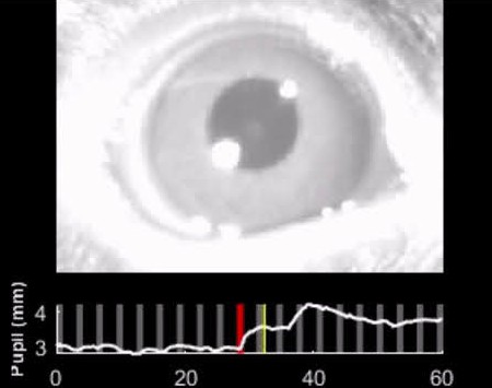 Good pupils of auditory science? Wide-eyed about the latest in the field? Use ires-Cre mice but wondering about the iris? Running out of terrible puns? Join us at Symposium 36 to see pupillometry in action at 10:30 am! <a href="/mariachait/">Maria Chait (she/her)</a> <a href="/AROMWM/">ARO</a>