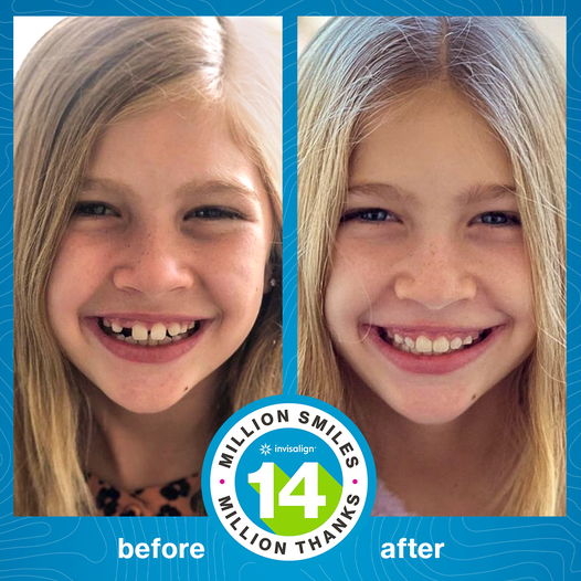 MiamiValleyDDS's tweet photo. 👏 Sharing a big transformation for #WowWednesday! Wow! #Invisalign
Ask us about our Invisalign treatment services today: https://t.co/bSR7Kg4sLY
Set up a free consultation for a quote: 513-398-0038 https://t.co/CGL5v3EMkM