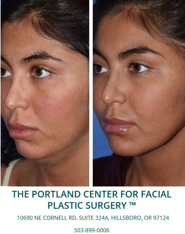 The Portland Center for Facial Plastic Surgery tweet media