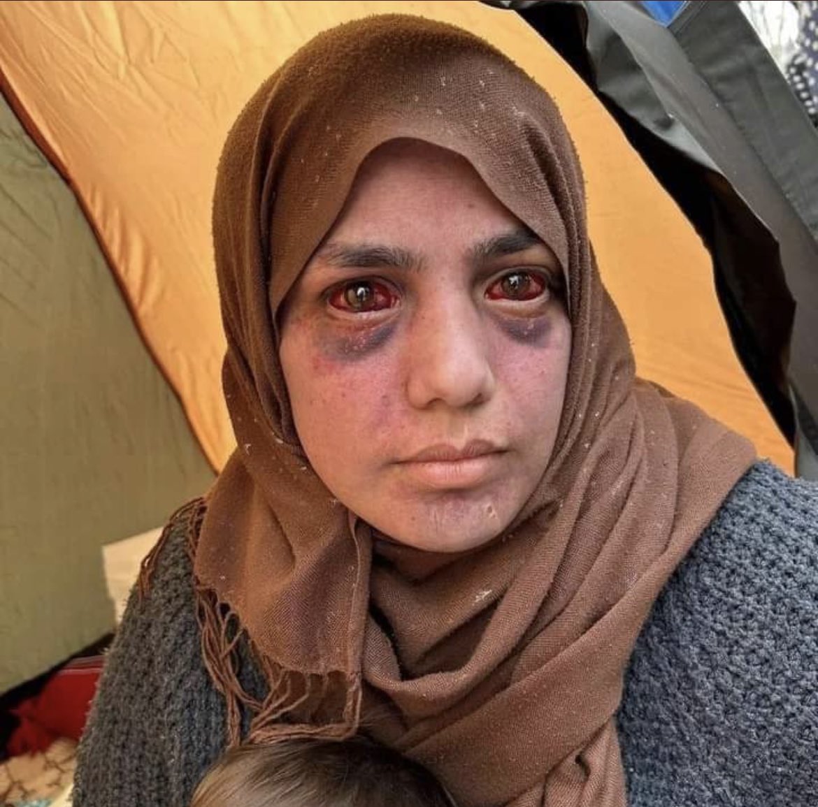 Zaman geçiyor herşey unutuluyor ama bu annenin kan ağlayan gözlerini unutmayın.