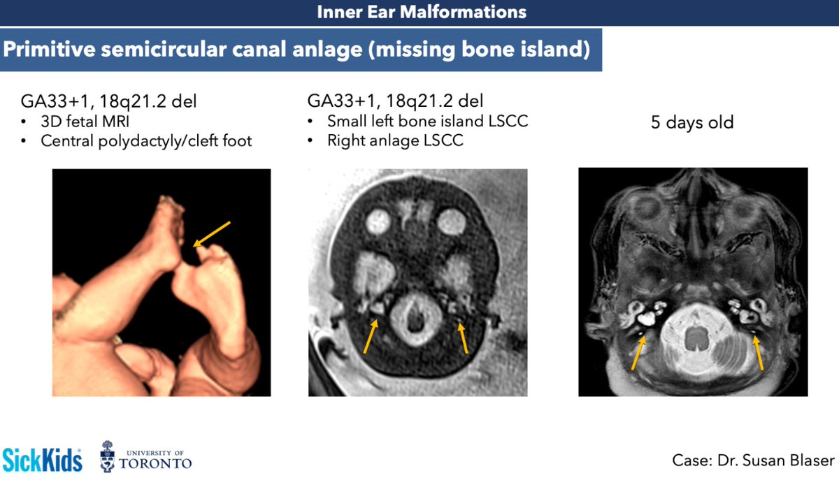 Matheus Dorigatti Soldatelli | MD PhD EDiNR/EDiPNR tweet media