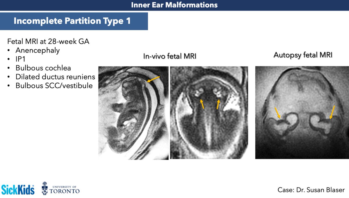 Matheus Dorigatti Soldatelli | MD PhD EDiNR/EDiPNR tweet media