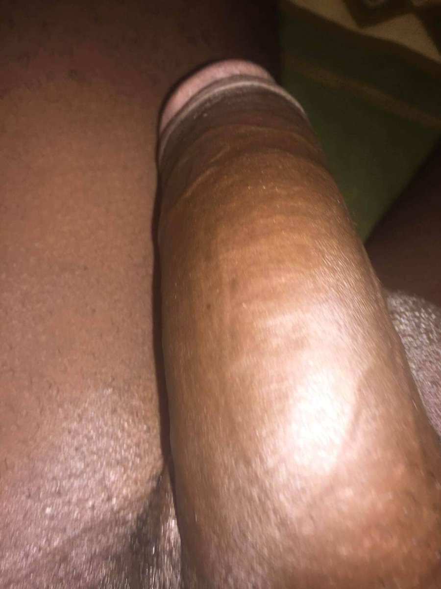 Ivan Fernandez tweet media