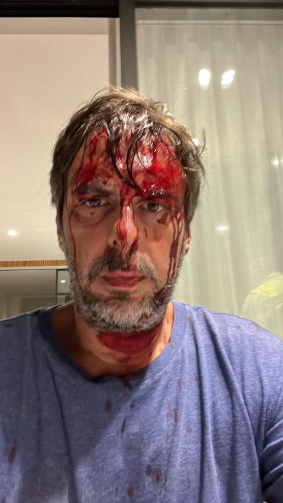 MariaFeldtmann's tweet photo. La #Inseguridad también llegó a #sanisidro. Registramos tres casos en Martínez en los últimos días. Dos fueron ingresos violentos en viviendas, en Lavalle entre Repetto y Mitre; el otro, en Repetto al 200. El tercero es un joven asaltado a punta de cuchillo en corrientes al 600. https://t.co/LsyI7CtsWw