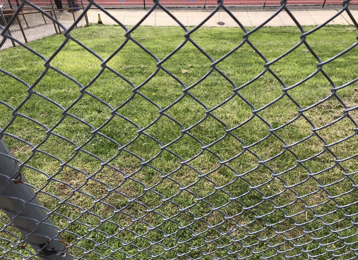 OhioStatePath's tweet photo. Pathology in everyday life
Case#3: Fence
This fence reminds you of normal histology of what organ?
#PathTwitter #Pathresidents #PathNewbies https://t.co/yIffuYLAGl