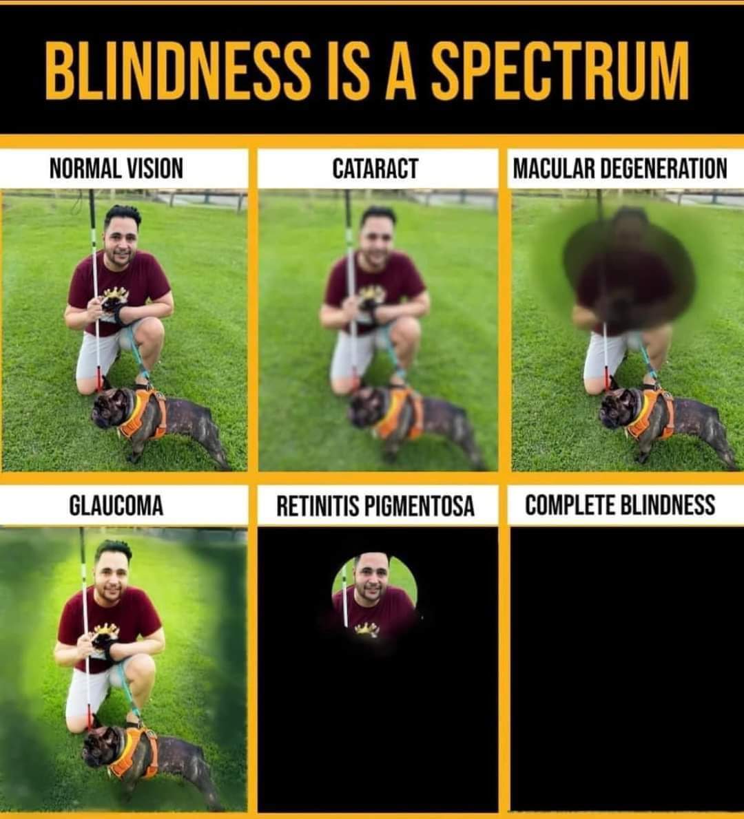 Blindness is definitely different for everyone and how they see the world.  As for me, it be like bottom left corner.  Crazy, eh?

#RPAwarenessMonth
#RetinitisPigmentosa
#UsherSyndrome
#BlindnessIsASpectrum
💙💜
