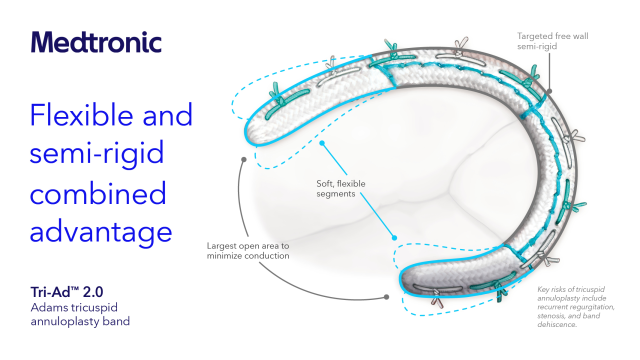 Axchun76's tweet photo. The Tri-Ad™ 2.0 band platform provides posterior remodeling for a dilated annulus while preserving 3-D motion during the cardiac cycle. Learn more: https://t.co/DXQ4E2HhgY See risk info: https://t.co/Cwy6AmxJFO #MedtronicEmployee https://t.co/6lXxEJ3nnq https://t.co/0Uw6AskPaj