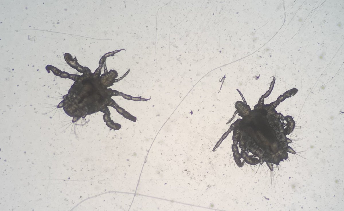 Unwelcome derm clinic visitors! Shout out to Dr. James Briley for harvesting these critters for the pic. #dermpath #dermtwitter #pathology #dermatology