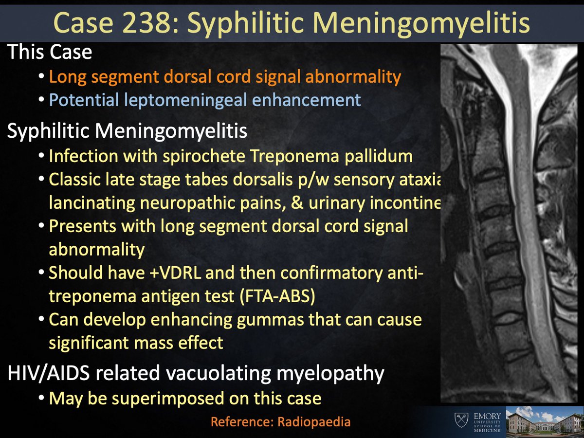Ryan B Peterson 🇸🇪 on Twitter "Answer Syphilitic Meningomyelitis