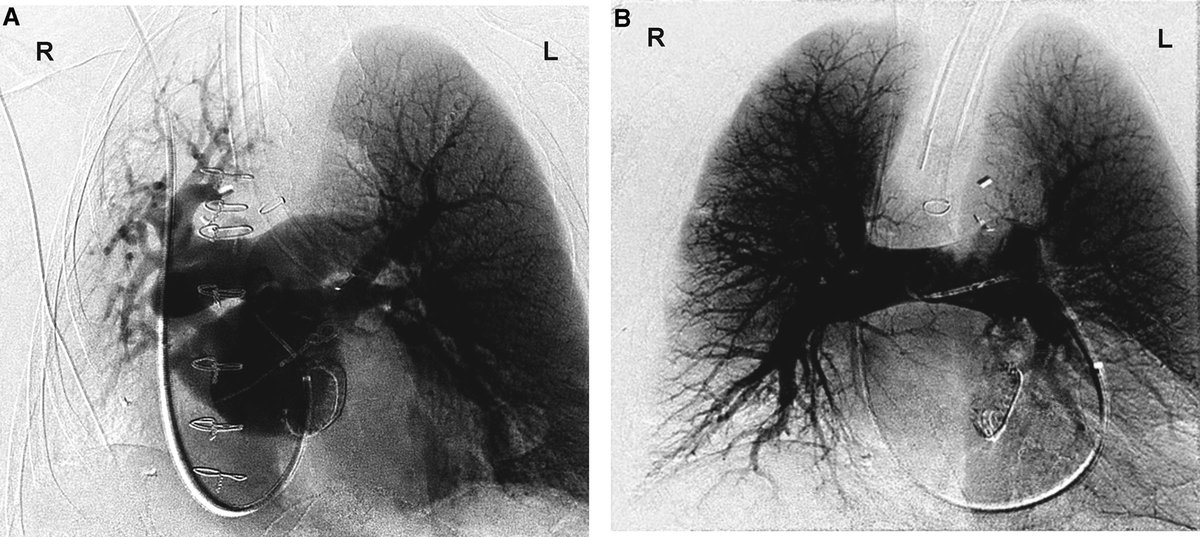 Anesthesiology on Twitter "Images in Anesthesiology Radiographic