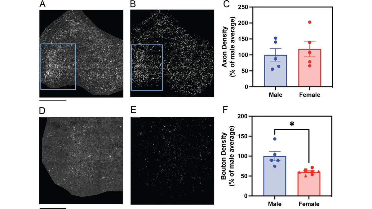 z_baram's tweet image. New! subtle but crucial structural connectivity differences between sexes (la petite difference 😎) in VTA-Amyg projections. Underlie behavior? pathology? Elegant, careful science from @DrGlasper  and team bsd.biomedcentral.com/articles/10.11…