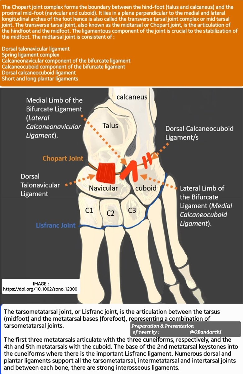 OBandarchi's tweet photo. The midfoot plays an important role in providing stability for the whole foot. The midfoot is divided into medial &amp; lateral compartments.The midfoot region also includes two transverse joints that provide minimal movement over the foot:  🛑Chopart joint  &amp;  🛑Lisfranc joint. https://t.co/dvrcr9utW3