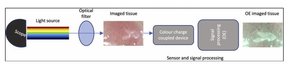Online now in GIE’s Articles in Press: “Computer-aided characterization of early cancer in Barrett’s esophagus on I-SCAN magnification imaging: a multicenter international study” by Mohamed Hussein et al. giejournal.org/article/S0016-…