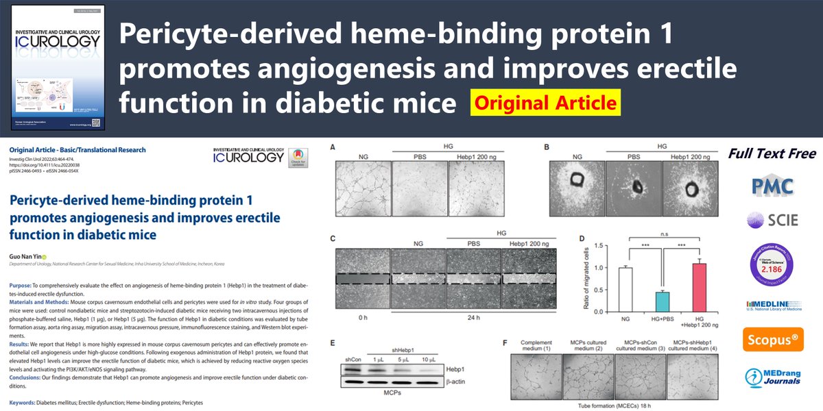 icurology's tweet photo. Pericyte-derived heme-binding protein 1 promotes angiogenesis and improves erectile function in diabetic mice
🌷https://t.co/YuHCq5C4h9
2022 Jul;63(4)Guo Nan Yin
#Diabetes_mellitus #Erectile_dysfunction #Heme_binding_proteins #Pericytes https://t.co/SOcRoOUzGr