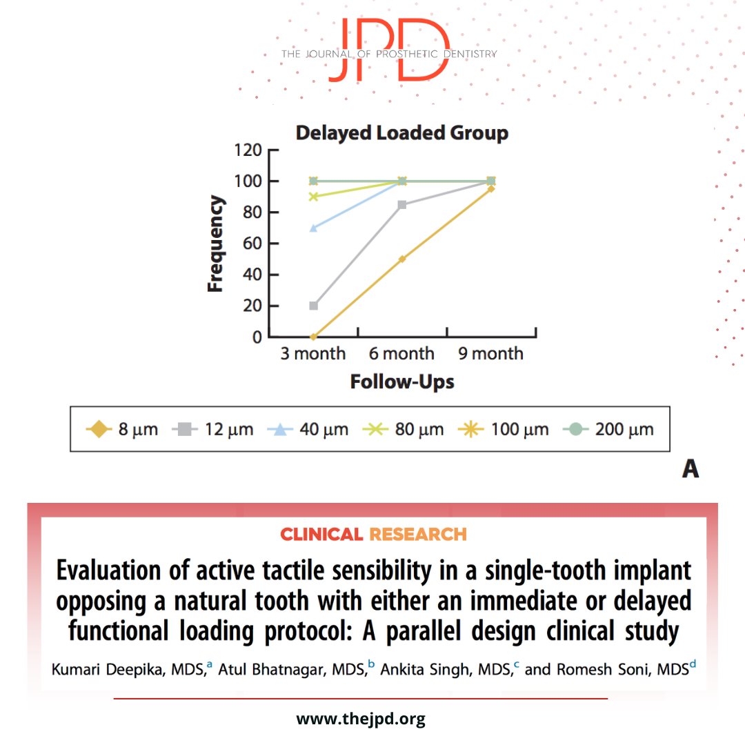 JPDentistry's tweet photo. This #inpress article from #theJPD applies a #splitmouthstudy to evaluate #osseoperception of implants with #immediateload vs. #delayedload: https://t.co/DKRo04KjTP https://t.co/dZ8PdpsNjR
