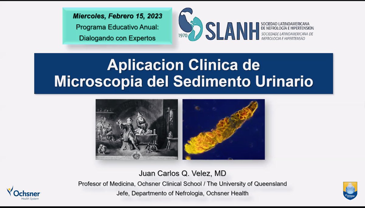 visanpolo's tweet photo. Utilidad Clinica del Sedimento Urinario, brillante exposición por @VelezNephHepato en miércoles de #SLANH avanzamos #PorLaSaludRenal @SLANH_ https://t.co/KzfFwysvFf