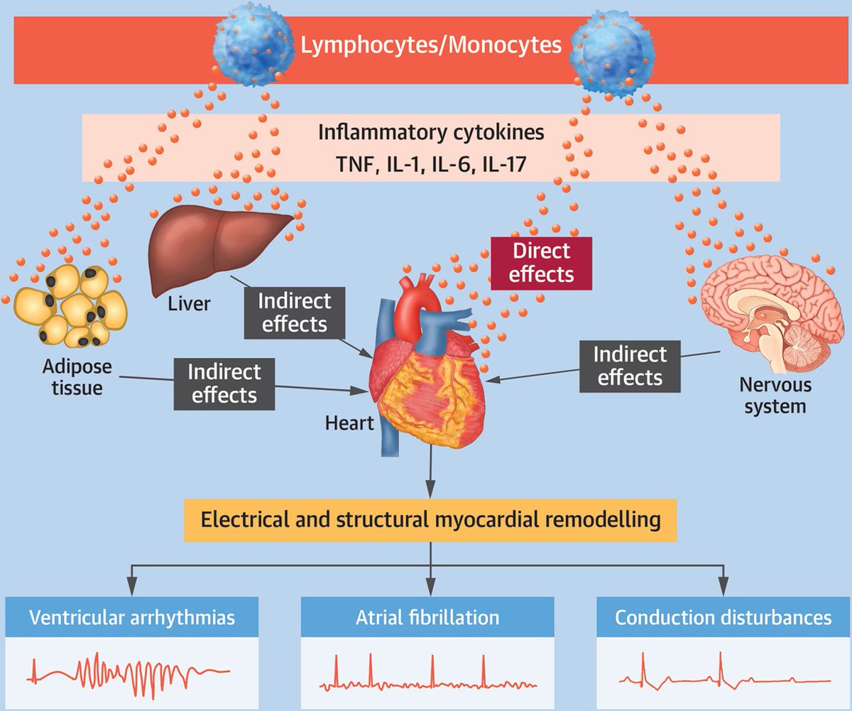 Fir(e)ing the Rhythm: Inflammatory Cytokines and Cardiac Arrhythmias sciencedirect.com/science/articl… New frontier - Anti-Inflammatory Therapies To Reduce Arrhythmic Risk @UVACVRC @CardioUva @unisiena @bvantassell @jordanakron1 @SempreRossa @LabMcnamara