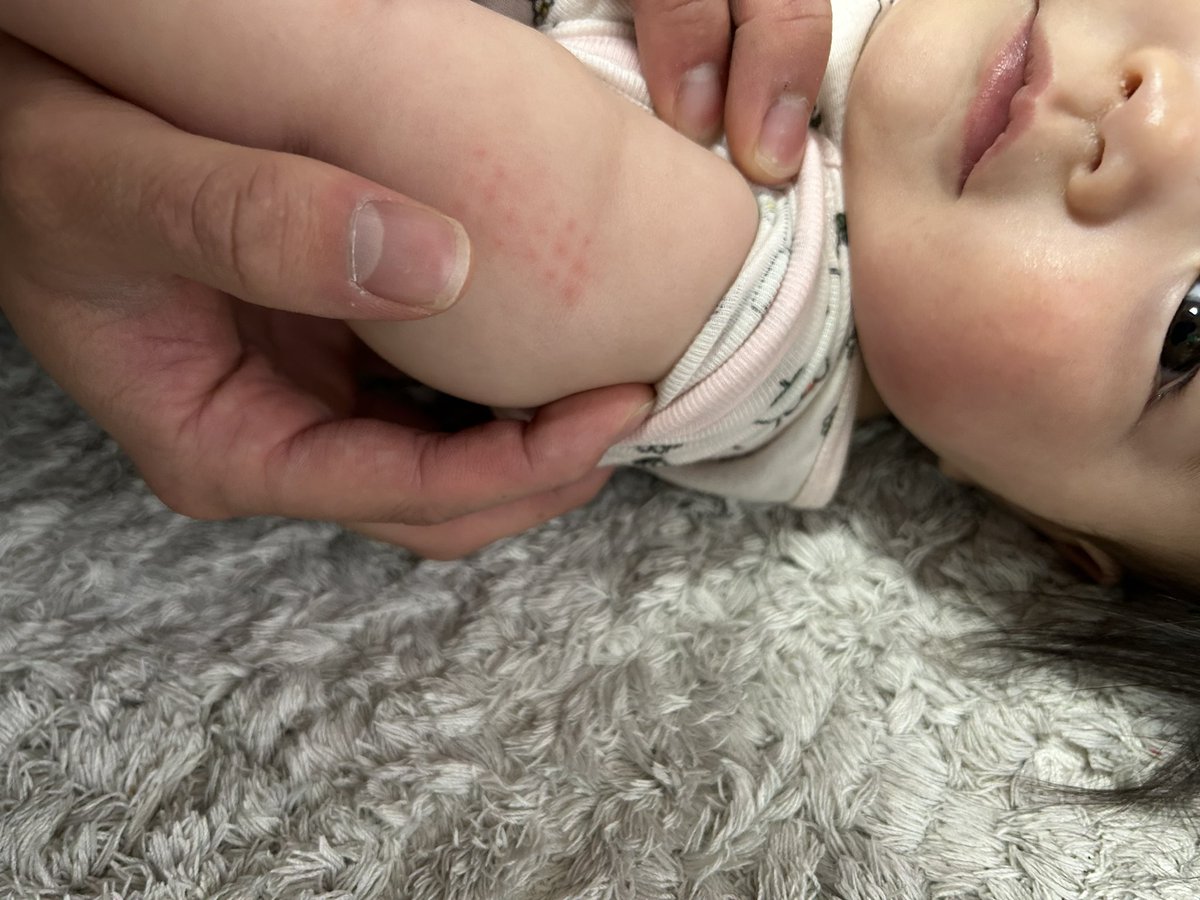 po_429's tweet photo. 昨日BCGしたんだよ📌
はやいもんで来週で半年👶🏻 https://t.co/hOhb8zMRIW