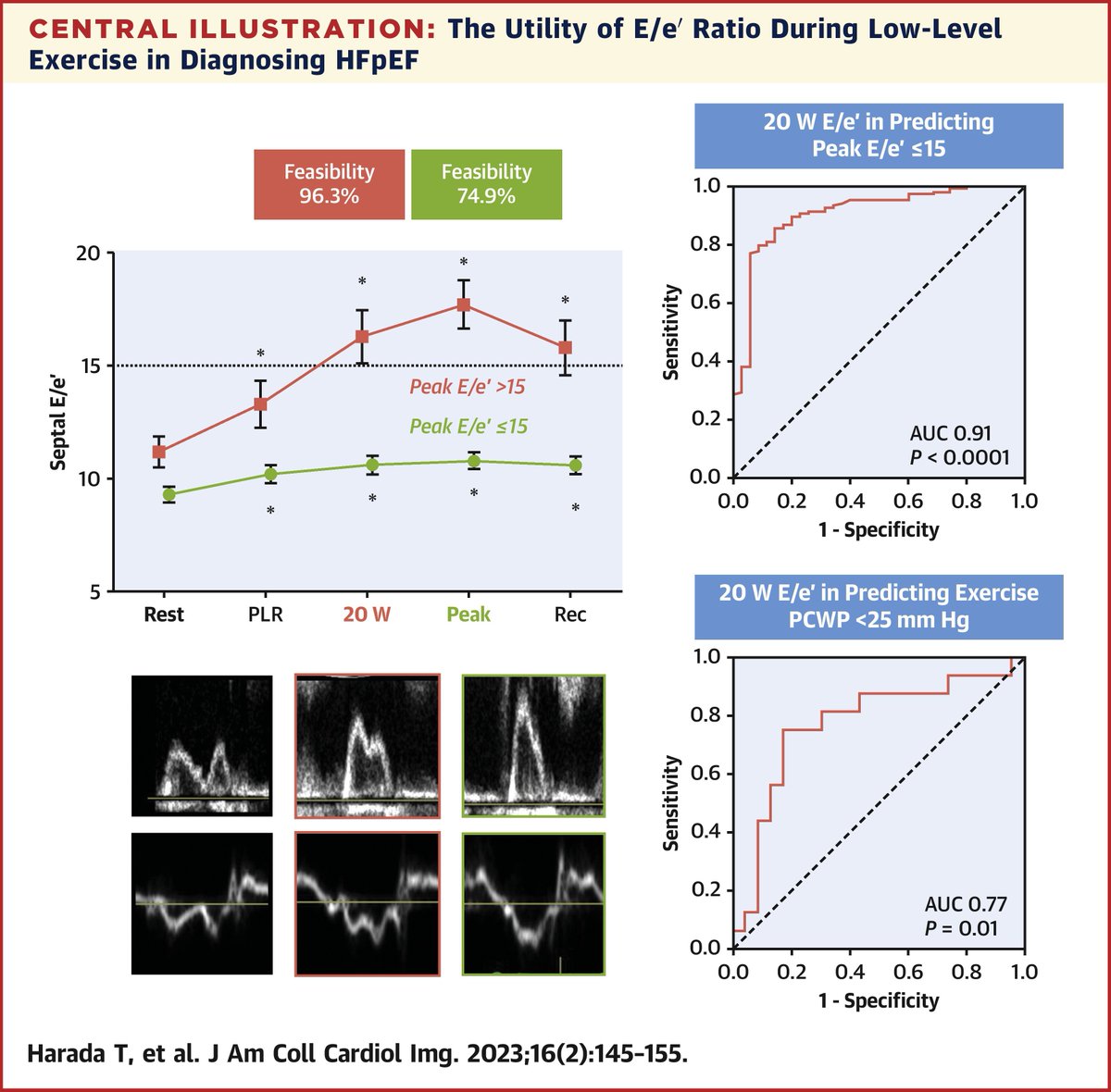 American College of Cardiology (@accintouch) on Twitter photo Can the E/e’ ratio during low-level (20-W) exercise predict noninvasive & invasive parameters of elevated filling pressures during exercise? And, can it be used to exclude a diagnosis of #HFpEF?
Read more: bit.ly/3XrTF12 #HeartFailure #JACCIMG Can the E/e’ ratio during low-level (20-W) exercise predict noninvasive & invasive parameters of elevated filling pressures during exercise? And, can it be used to exclude a diagnosis of #HFpEF?
Read more: bit.ly/3XrTF12 #HeartFailure #JACCIMG