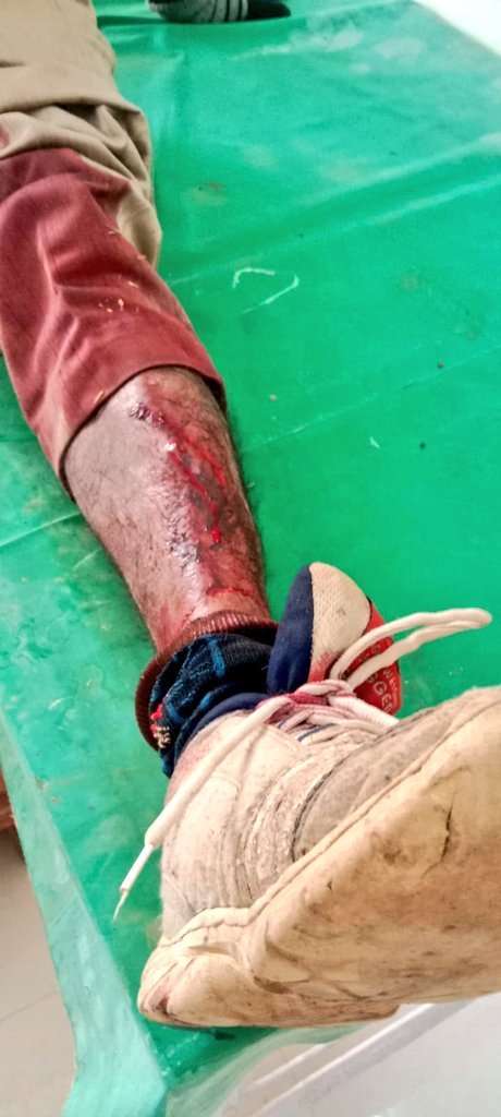 szarita's tweet photo. #PollViolence #TripuraElections2023

BJP goons attacked Chandan Das and Shipan Majumdar in Shantir Bazar, police are  mere spectators in the entire incident.

@ECISVEEP
@SpokespersonECI @kirangitteias
@ceotripura @Tripura_Police
@drajoykumar https://t.co/LIEVbc3jum